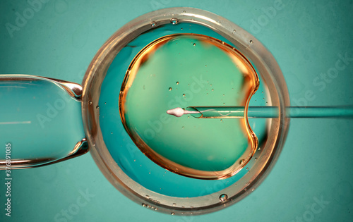 Ovum with needle and sperm for artificial insemination or in vitro fertilization. Concept of artificial insemination or fertility treatment. Image photo