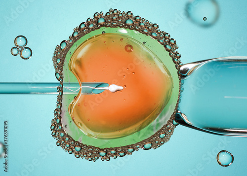 фотографія Ovum with needle and sperm for artificial insemination or in vitro fertilization