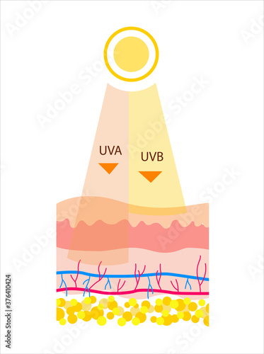 Flat Vector illustration of UVB and UVA radiation. The difference between the types of radiation 
in sunlight. Cartoon style illustration about UVA penetrates deeper than UVB. UVB rays of the sun pen