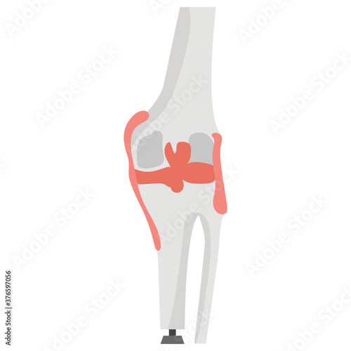 Artificial Human Knee