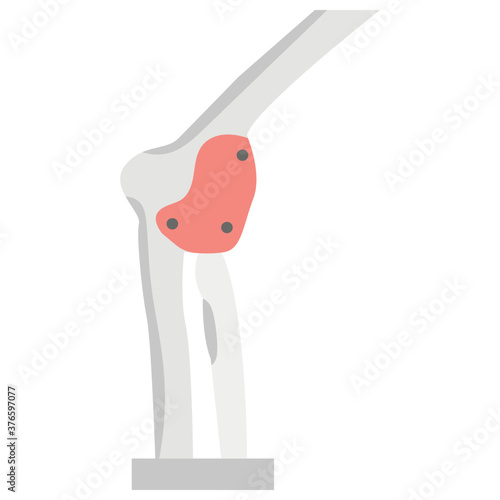 Knee Joint