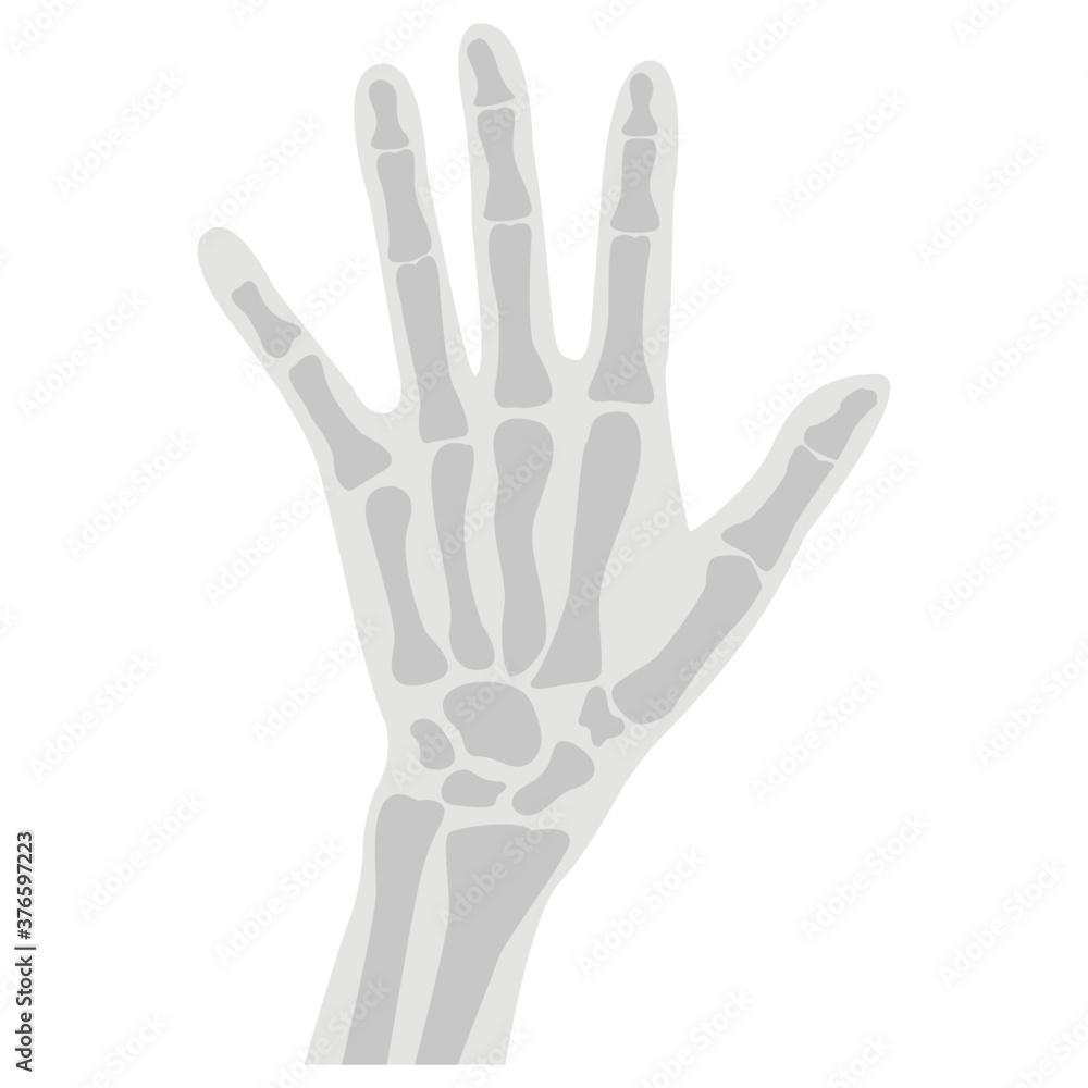 Fototapeta premium Hand X Ray