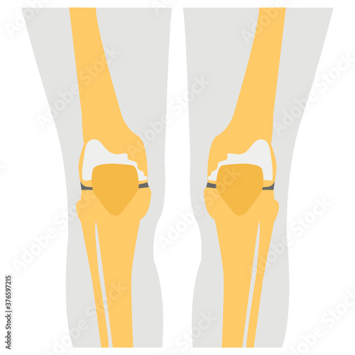 Knee Joints