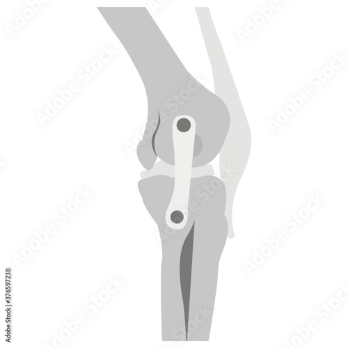 Knee Joints