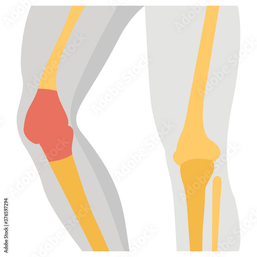 Knee Bones