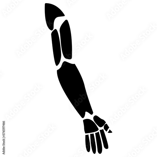 Prosthetic Arm