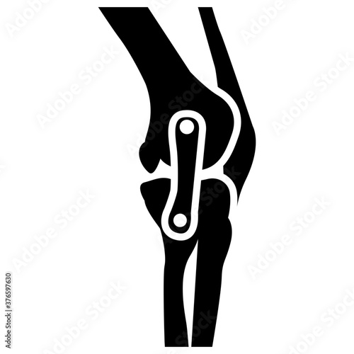Knee Joints