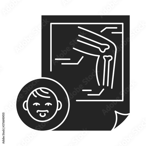 Pediatric orthopedics black glyph icon. Check and treatment in fracture and sprain children. Pictogram for web page, mobile app, promo.