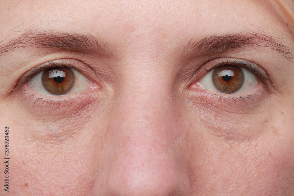 mirada de mujer adulta con ojos marrones sin maquillaje y pequeñas ojeras y  cejas sin sacar Stock Photo | Adobe Stock