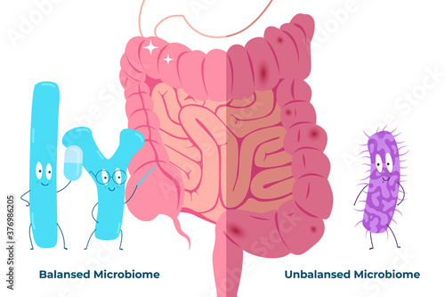 Bad and good bacteria on the background of the intestine. How bad and good bacteria affect the gut. Editable vector illustration.