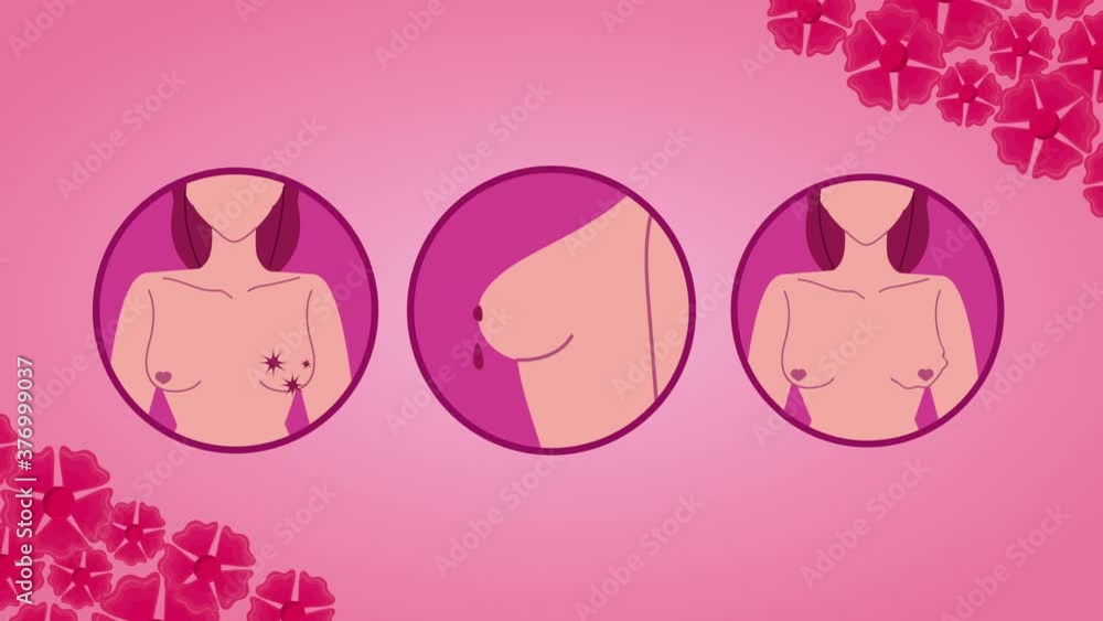 breast cancer campaign animation with women torsos and flowers breast cancer campaign animation with women torsos and flowers