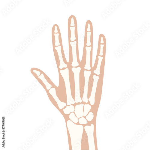 Arthrits x ray