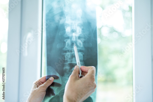 Doctor analyzing patient's spine x-ray.