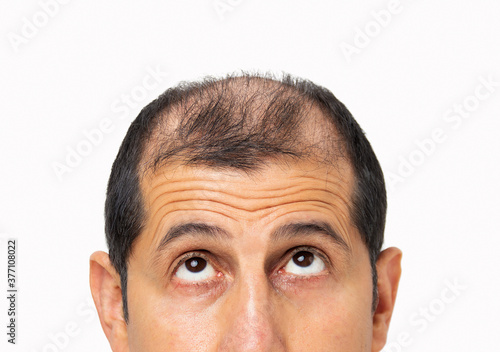 Young bald man  over white isolated background looking up sad, upset, unhappy and depressed.