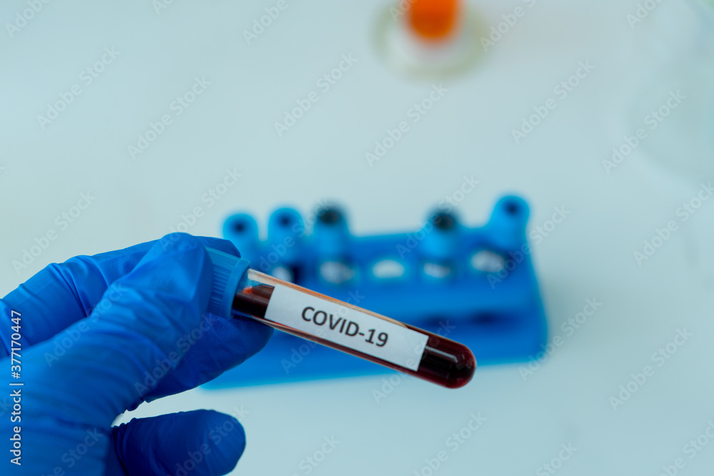 Obraz premium test tube containing blood sample infection from flu disease tested in medical science laboratory