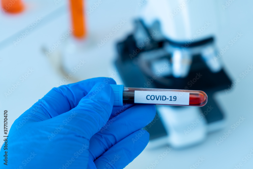 test tube containing blood sample infection from flu disease tested in medical science laboratory test tube containing blood sample infection from flu disease tested in medical science laboratory