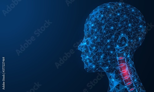 Disease of the cervical spine. Medical concept with a pain in the neck. Polygonal human head. Construction of lines and dots. Blue background.