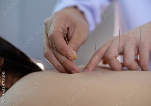 acupuncture young women.