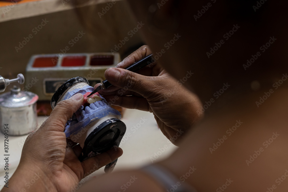 Cutting the wax of the prosthetic jaw Cutting the wax of the prosthetic jaw