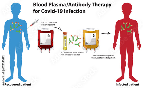 Blood Plasma/Antibody Therapy for Covid-19 Infection infographic