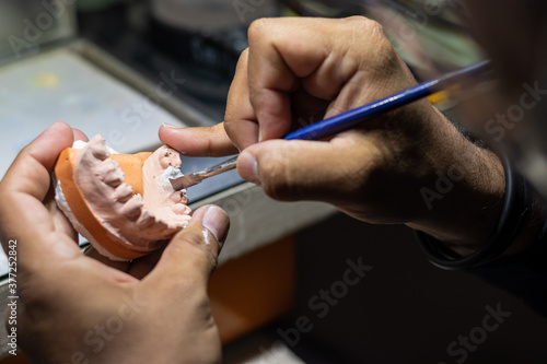 Prosthetic tooth in a dental laboratory being made