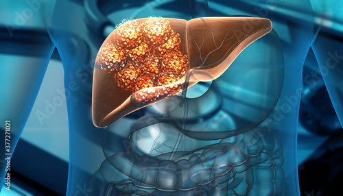 Human liver cancer cell growth. 3d illustration. photo