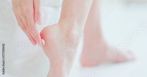 Woman applying cream onto heel