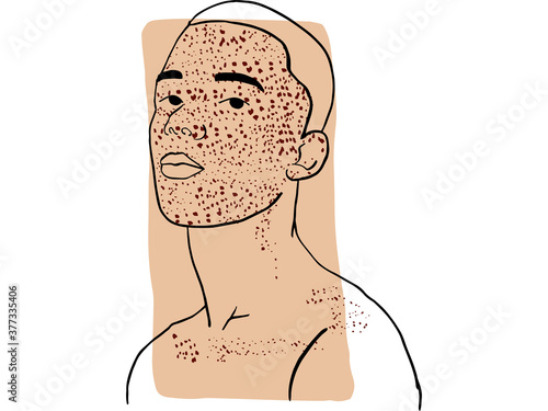 Hand-draw outline portrait of a young man with his face cover by freckles and dark beige sample color