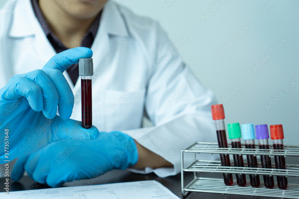 technician of health with blood tubes in the clinical lab for analytical / hand of a doctor holding a blood sample in tube test for analysis in the laboratory technician of health with blood tubes in the clinical lab for analytical / hand of a doctor holding a blood sample in tube test for analysis in the laboratory