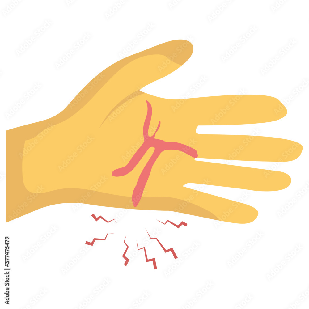 Obraz premium Hand Bleeding 