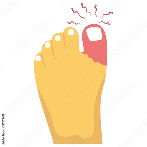 Big Toe Injured 