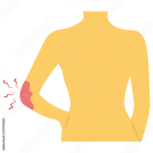 Elbow Bleeding 