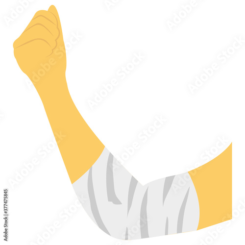 Elbow Fractured 