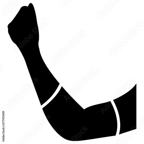 Elbow Fractured 