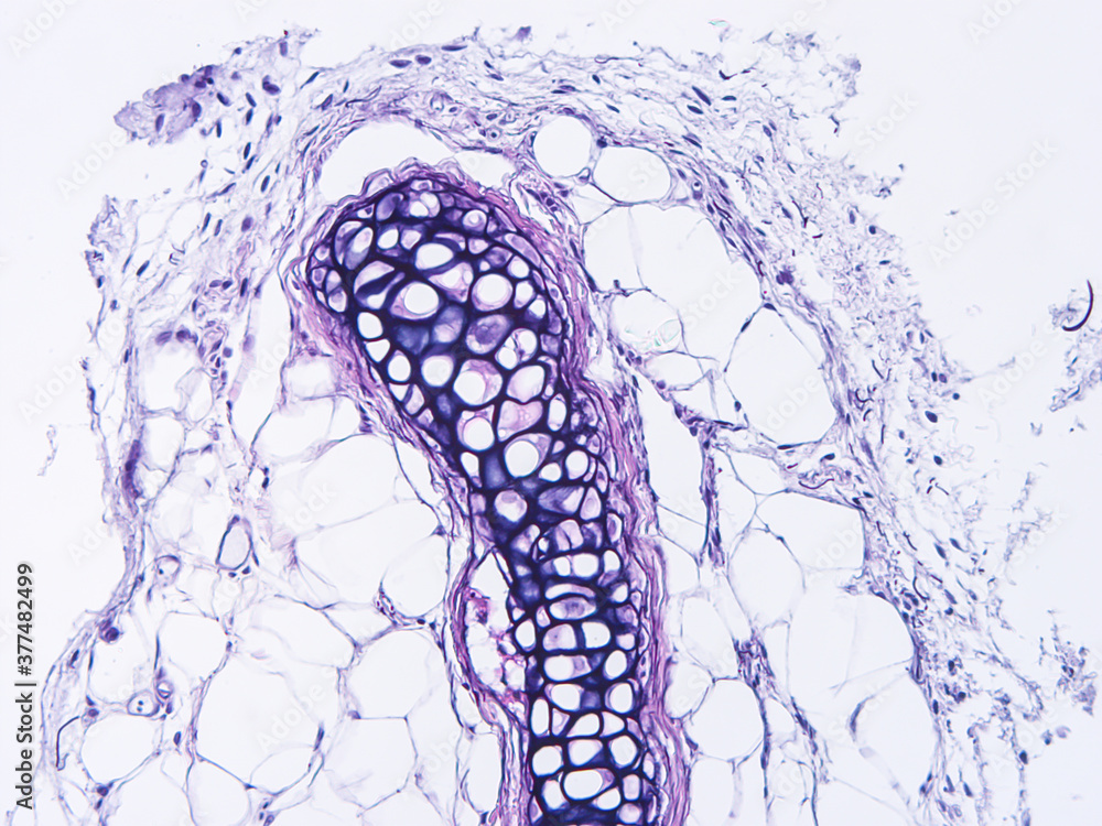 Histology of human tissue, show epithelial tissue and connective tissue ...