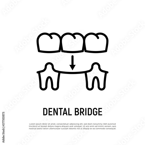Dental bridge thin line icon. Dentistry, prosthesis. Tooth restoration. Vector illustration.