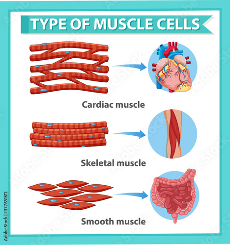 Information poster of muscle cells