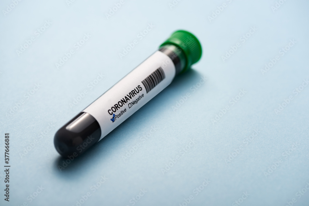 Positive coronavirus test tube isolated on blue background. Positive coronavirus test tube isolated on blue background.