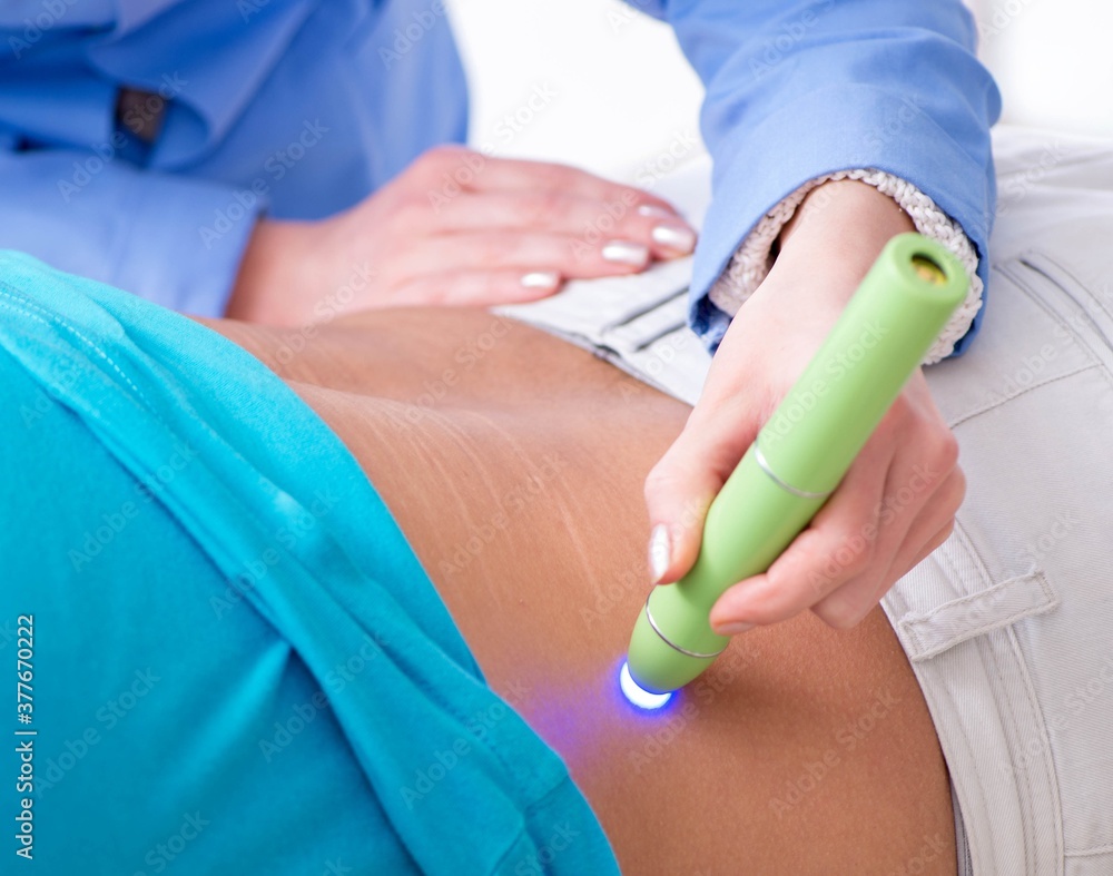Patient in clinic undergoing laser scar removal Patient in clinic undergoing laser scar removal