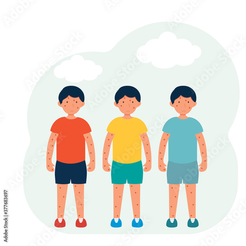 Group of children with skin hives. Allergy, rubella, measles. Illustration in flat style.