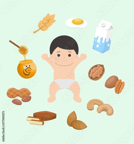 Itchy and allergic foods for baby boys, boys, wheat, eggs, milk, nuts, walnuts, walnuts, cashews, almonds, dried beans, peanuts, honey, set