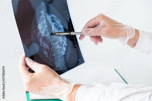 Quadro su tela Female doctor analyzing mammography results on x-ray