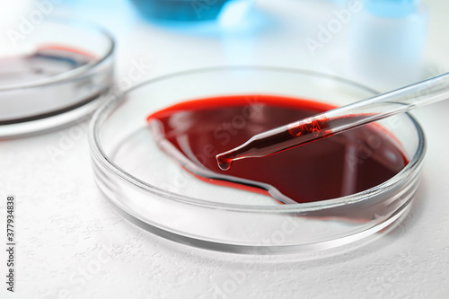Dripping blood from pipette into Petri dish on table, closeup. Laboratory analysis