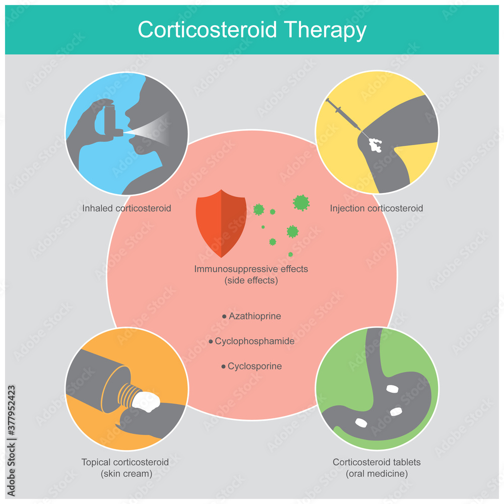 Corticosteroid Therapy. Illustration explain the therapy inflammatory disease in human by use