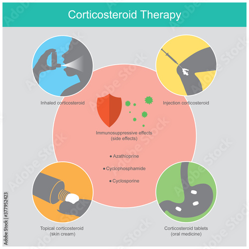 Corticosteroid Therapy. Illustration explain the therapy inflammatory disease in human by use synthetic. corticosteroids substance an effective in the immunosuppressive effect..