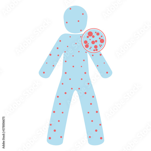 Isolated zika virus bite illness icon - Vector