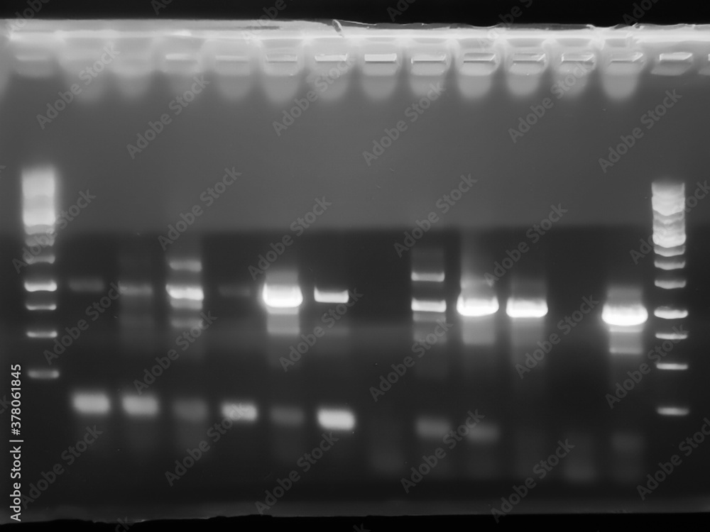 result of agarose gel electrophoresis of PCR products. separation of DNA fragments amplified