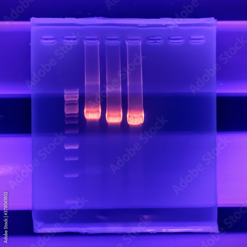 result of agarose gel electrophoresis of PCR products. separation of DNA fragments amplified with the PCR is used for genotyping of transgenic lines in search for heterozygeous lines with tDNA insert