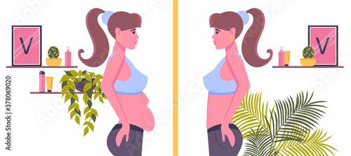 Overweight. Reducing fat in the abdominal area. Woman's body before and after weight loss, diet, fitness or liposuction.