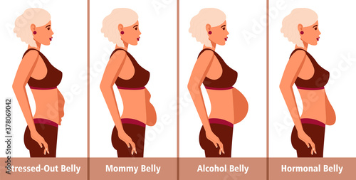 Types of Tummies for women. Post-pregnancy, menopausal hormonal belly, beer belly, bloating belly and overweight.